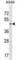 1-Acylglycerol-3-Phosphate O-Acyltransferase 5 antibody, abx030540, Abbexa, Western Blot image 