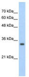 Zinc Finger Protein 227 antibody, TA341532, Origene, Western Blot image 