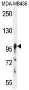 Axin 1 antibody, AP50319PU-N, Origene, Western Blot image 