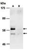 Protein Inhibitor Of Activated STAT 4 antibody, orb66713, Biorbyt, Western Blot image 