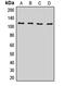 BICD Cargo Adaptor 2 antibody, LS-C668325, Lifespan Biosciences, Western Blot image 