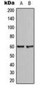 Coiled-Coil Domain Containing 102B antibody, orb224123, Biorbyt, Western Blot image 