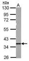 PDZ And LIM Domain 3 antibody, PA5-31547, Invitrogen Antibodies, Western Blot image 