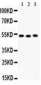 F7 antibody, PA2060, Boster Biological Technology, Western Blot image 