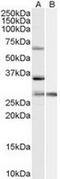 Pre-MRNA Processing Factor 31 antibody, TA302582, Origene, Western Blot image 