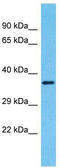 Olfactory Receptor Family 2 Subfamily A Member 42 antibody, TA337486, Origene, Western Blot image 
