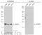 Cytochrome B-245 Alpha Chain antibody, GTX133970, GeneTex, Western Blot image 