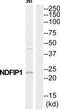 NEDD4 family-interacting protein 1 antibody, TA315834, Origene, Western Blot image 