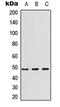 Interleukin 13 Receptor Subunit Alpha 1 antibody, LS-C359028, Lifespan Biosciences, Western Blot image 