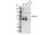 DNA Methyltransferase 3 Alpha antibody, 32578S, Cell Signaling Technology, Western Blot image 