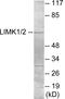 LIM Domain Kinase 1 antibody, EKC1749, Boster Biological Technology, Western Blot image 