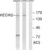 HECT, C2 And WW Domain Containing E3 Ubiquitin Protein Ligase 2 antibody, LS-C119928, Lifespan Biosciences, Western Blot image 