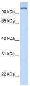 Poly(ADP-Ribose) Polymerase Family Member 9 antibody, TA334269, Origene, Western Blot image 