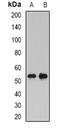 Phospholipid Transfer Protein antibody, orb381961, Biorbyt, Western Blot image 