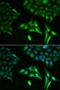 Acyl-CoA Dehydrogenase Short Chain antibody, LS-C346294, Lifespan Biosciences, Immunofluorescence image 