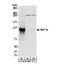 BAF Chromatin Remodeling Complex Subunit BCL11A antibody, NB600-261, Novus Biologicals, Western Blot image 