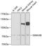Semaphorin-3B antibody, 22-625, ProSci, Western Blot image 