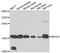 N(Alpha)-Acetyltransferase 20, NatB Catalytic Subunit antibody, A11521, Boster Biological Technology, Western Blot image 