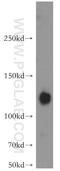 ATPIA antibody, 21565-1-AP, Proteintech Group, Western Blot image 