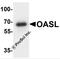 2'-5'-Oligoadenylate Synthetase Like antibody, 7775, ProSci, Western Blot image 