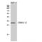 Carcinoembryonic Antigen Related Cell Adhesion Molecule 6 antibody, LS-C387671, Lifespan Biosciences, Western Blot image 
