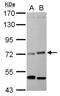 Eukaryotic translation initiation factor 2-alpha kinase 1 antibody, NBP2-16291, Novus Biologicals, Western Blot image 