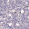 DDB1 And CUL4 Associated Factor 12 Like 2 antibody, HPA048981, Atlas Antibodies, Immunohistochemistry frozen image 