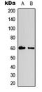 Cyclin B1 antibody, LS-C358934, Lifespan Biosciences, Western Blot image 