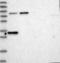 Pleckstrin Homology Like Domain Family B Member 1 antibody, NBP1-90451, Novus Biologicals, Western Blot image 
