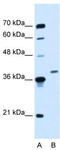 Homeobox D11 antibody, TA329718, Origene, Western Blot image 