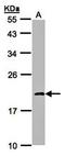 NADH dehydrogenase [ubiquinone] iron-sulfur protein 4, mitochondrial antibody, orb73686, Biorbyt, Western Blot image 