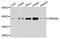 Protein Kinase AMP-Activated Non-Catalytic Subunit Beta 1 antibody, STJ114365, St John