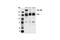 Breakpoint cluster region protein antibody, 3902S, Cell Signaling Technology, Western Blot image 