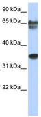 NK3 Homeobox 2 antibody, TA332156, Origene, Western Blot image 