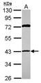 Ribonucleoside-diphosphate reductase subunit M2 B antibody, GTX109620, GeneTex, Western Blot image 
