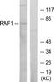 Raf-1 Proto-Oncogene, Serine/Threonine Kinase antibody, TA313051, Origene, Western Blot image 