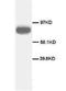 Transferrin Receptor antibody, AP23306PU-N, Origene, Western Blot image 