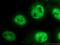 DNA Topoisomerase I antibody, 20705-1-AP, Proteintech Group, Immunofluorescence image 
