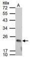 Probable DNA dC->dU-editing enzyme APOBEC-3C antibody, PA5-27629, Invitrogen Antibodies, Western Blot image 