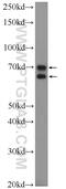 Nuclear Speckle Splicing Regulatory Protein 1 antibody, 21360-1-AP, Proteintech Group, Western Blot image 