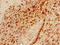 YY1-associated factor 2 antibody, orb34330, Biorbyt, Immunohistochemistry paraffin image 