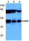 RAB8B, Member RAS Oncogene Family antibody, PA5-37209, Invitrogen Antibodies, Western Blot image 