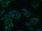 Lysosomal acid phosphatase antibody, 15236-1-AP, Proteintech Group, Immunofluorescence image 