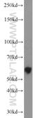 Lysophosphatidylcholine Acyltransferase 1 antibody, 16112-1-AP, Proteintech Group, Western Blot image 