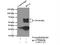 B-cell lymphoma 3 protein antibody, 23959-1-AP, Proteintech Group, Immunoprecipitation image 
