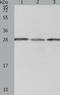 Proteasome 26S Subunit, Non-ATPase 9 antibody, TA324245, Origene, Western Blot image 