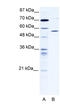 Chaperonin Containing TCP1 Subunit 4 antibody, 28-040, ProSci, Western Blot image 