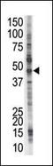 Pleckstrin And Sec7 Domain Containing 4 antibody, PA5-11942, Invitrogen Antibodies, Western Blot image 