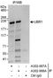 Ubiquitin Protein Ligase E3 Component N-Recognin 1 antibody, A302-987A, Bethyl Labs, Immunoprecipitation image 