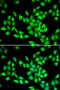 PIMT antibody, STJ28767, St John